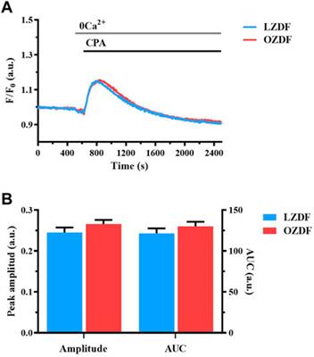 Alterations of the Ca2+ clearing mechanisms by type 2 diabetes in aortic smooth muscle cells of Zucker diabetic fatty rat